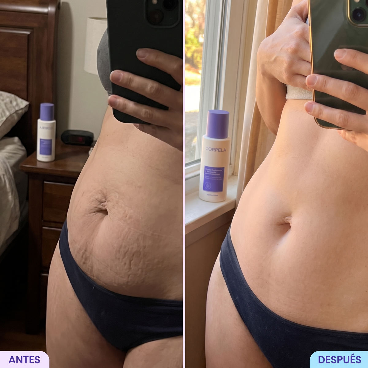 Corpela® Reafirmante Densificante Piel Abdominal