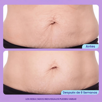 Corpela® Reafirmante Densificante Piel Abdominal
